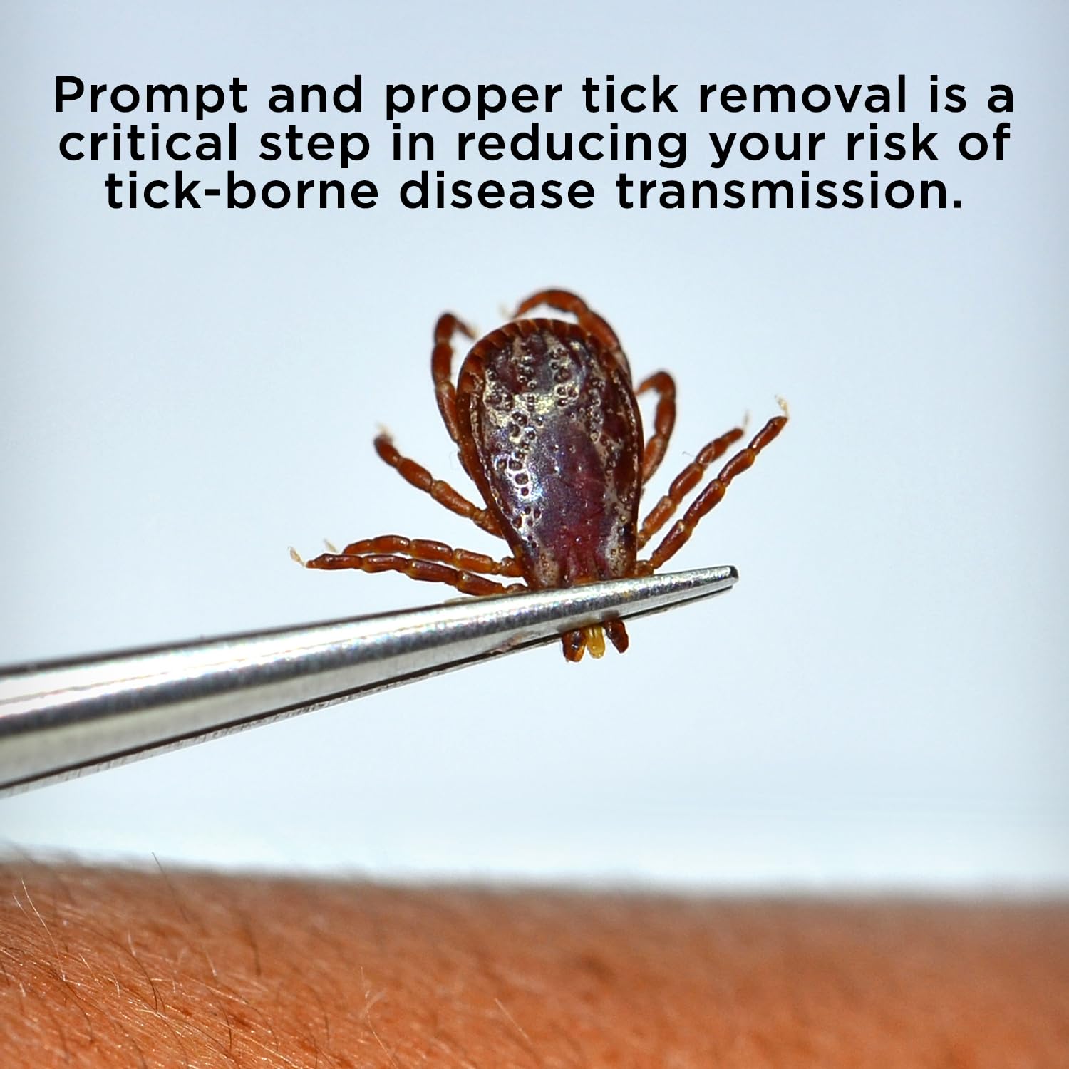 BUG BITE THING easy-grip handle enables quick confident tick removal.