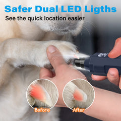 Casfuy dual LED lights overlaying visibility for safer nail trimming.