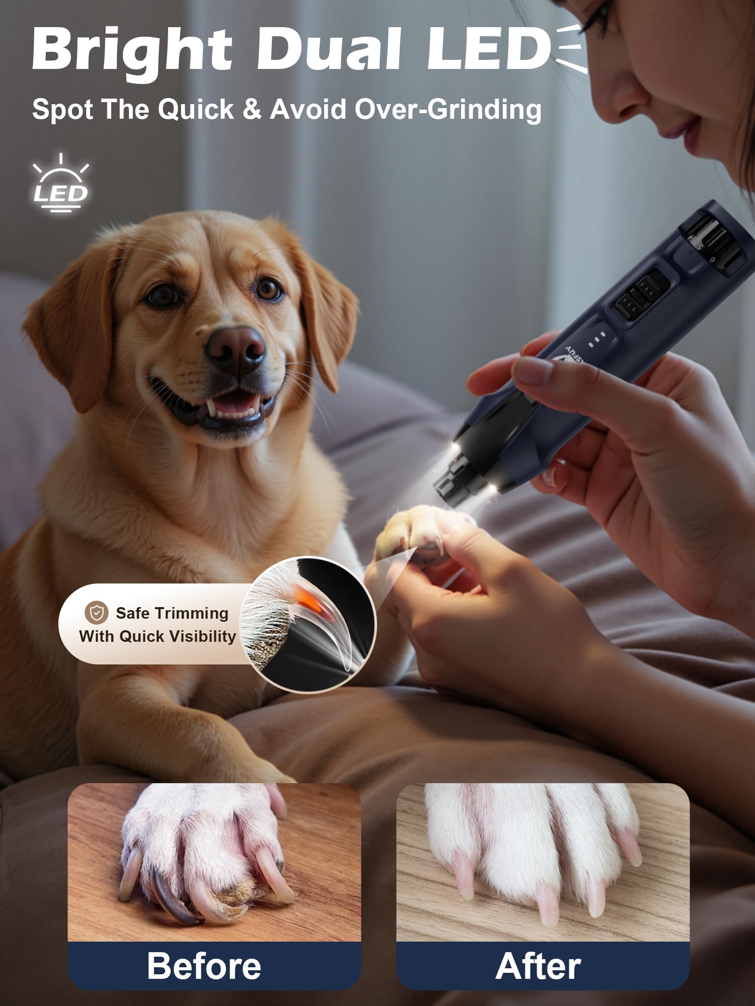 Casfuy dual LED lights illuminate nails for precise trimming