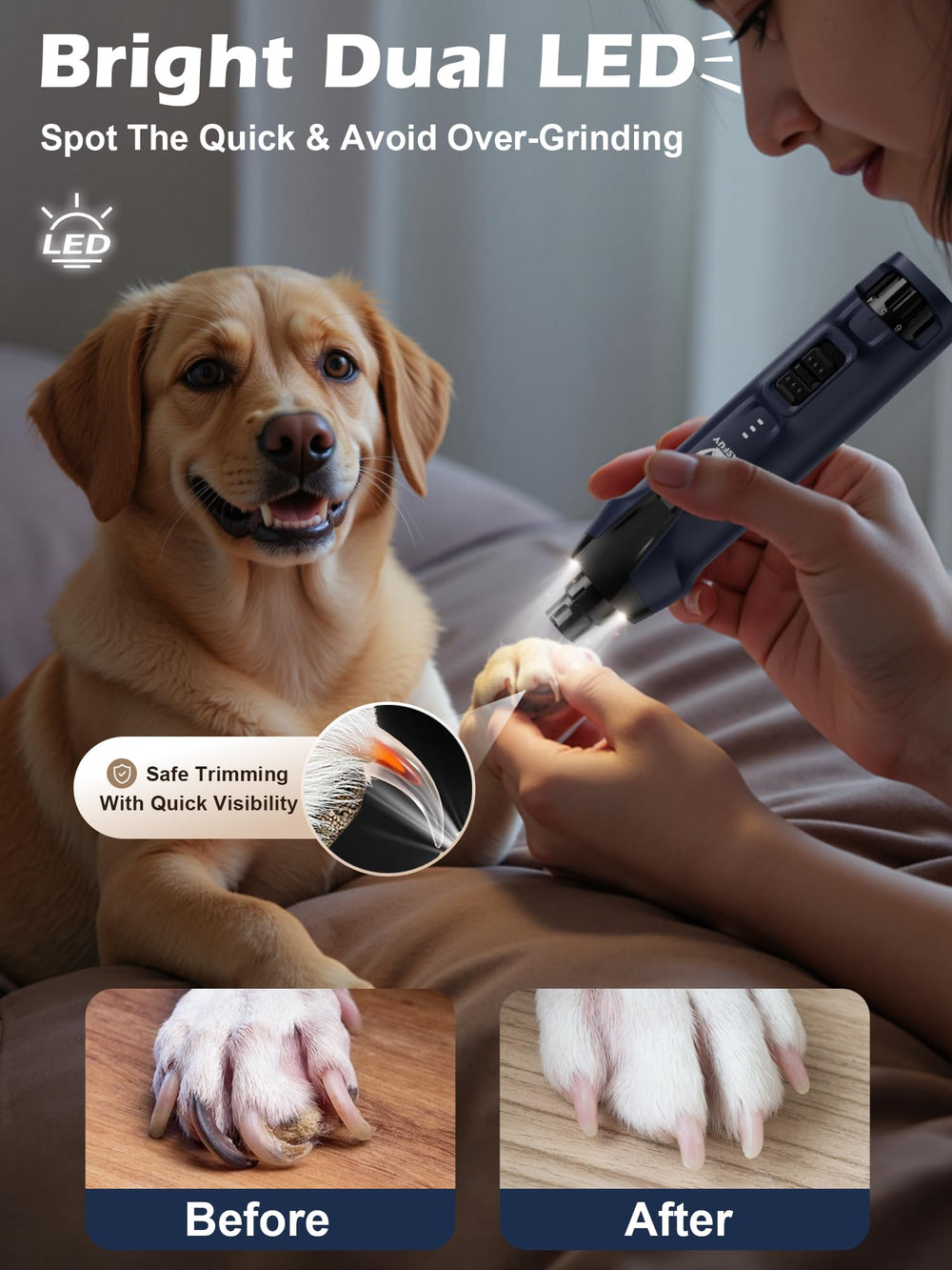 Casfuy dual LED lights illuminate nails for precise trimming