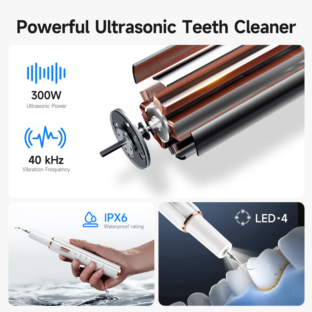 Curvy Moon Ultrasonic Dog Teeth Cleaning Kit five modes dial for gentle scaling.