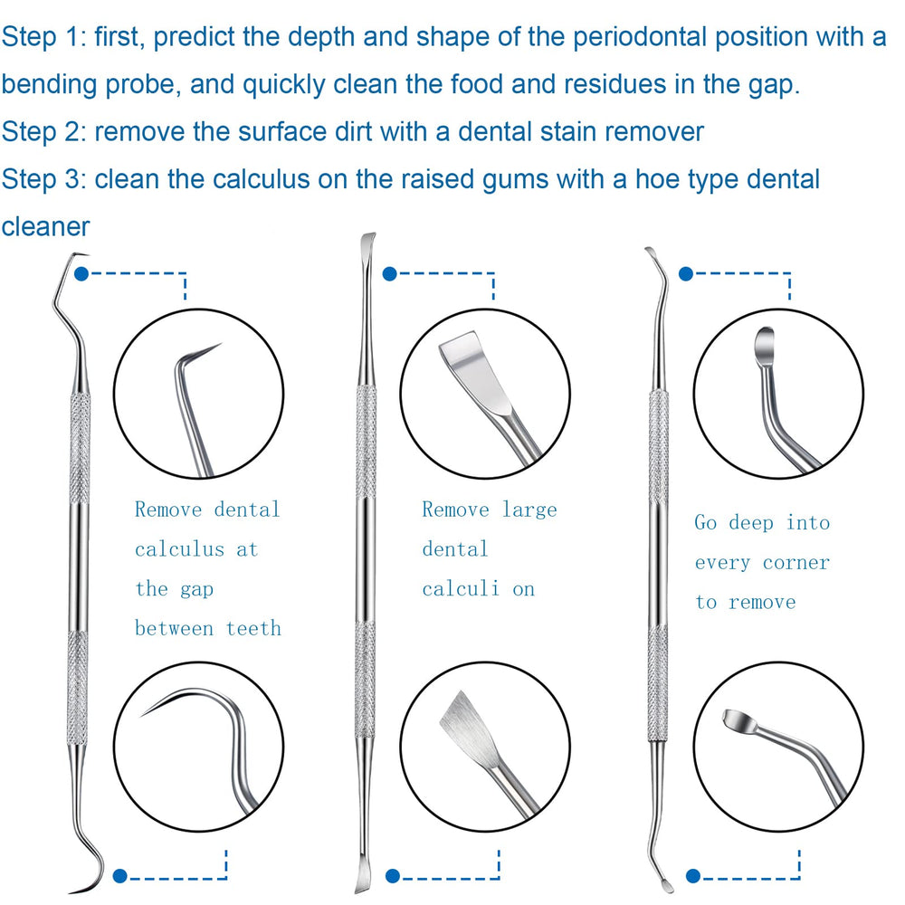 Hotop stainless steel dog dental scraper tool for easy access to stubborn buildup