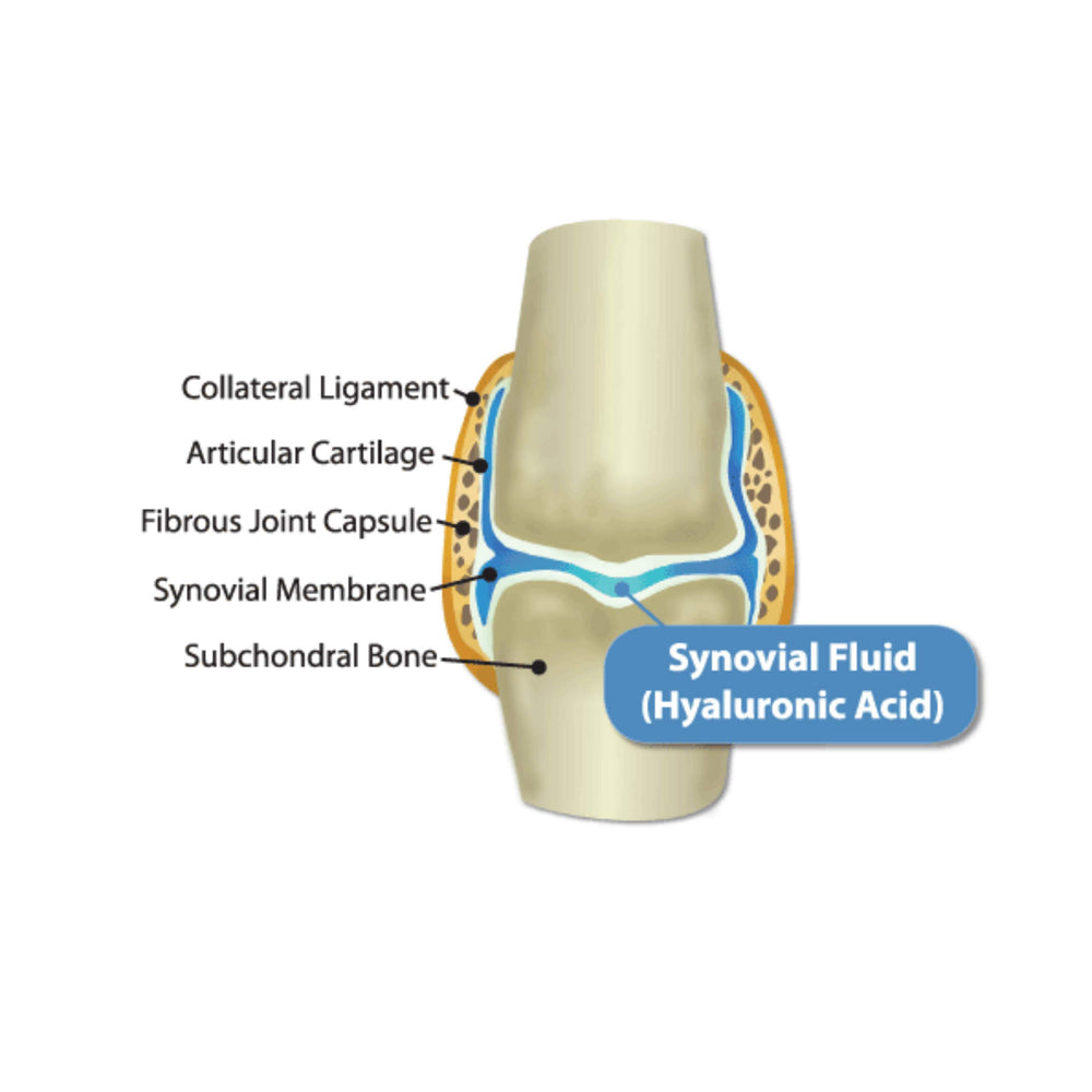 Hyalogic HyaFlex Pro cartilage support visual emphasizes cushioning joints