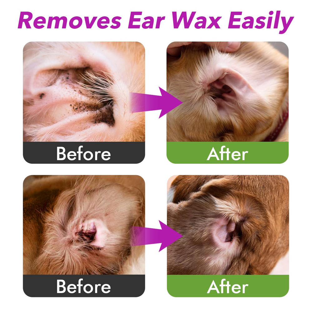 MEIQIHOME ear cleaner cotton swabs kit for thorough debris removal.