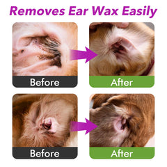 MEIQIHOME ear cleaner cotton swabs kit for thorough debris removal.