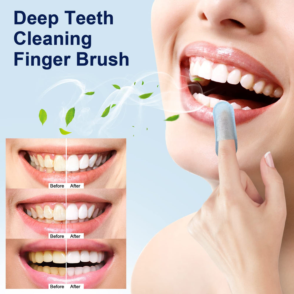 MySmile teeth wipes sugar-free mint flavor promotes fresh breath and clean mouth