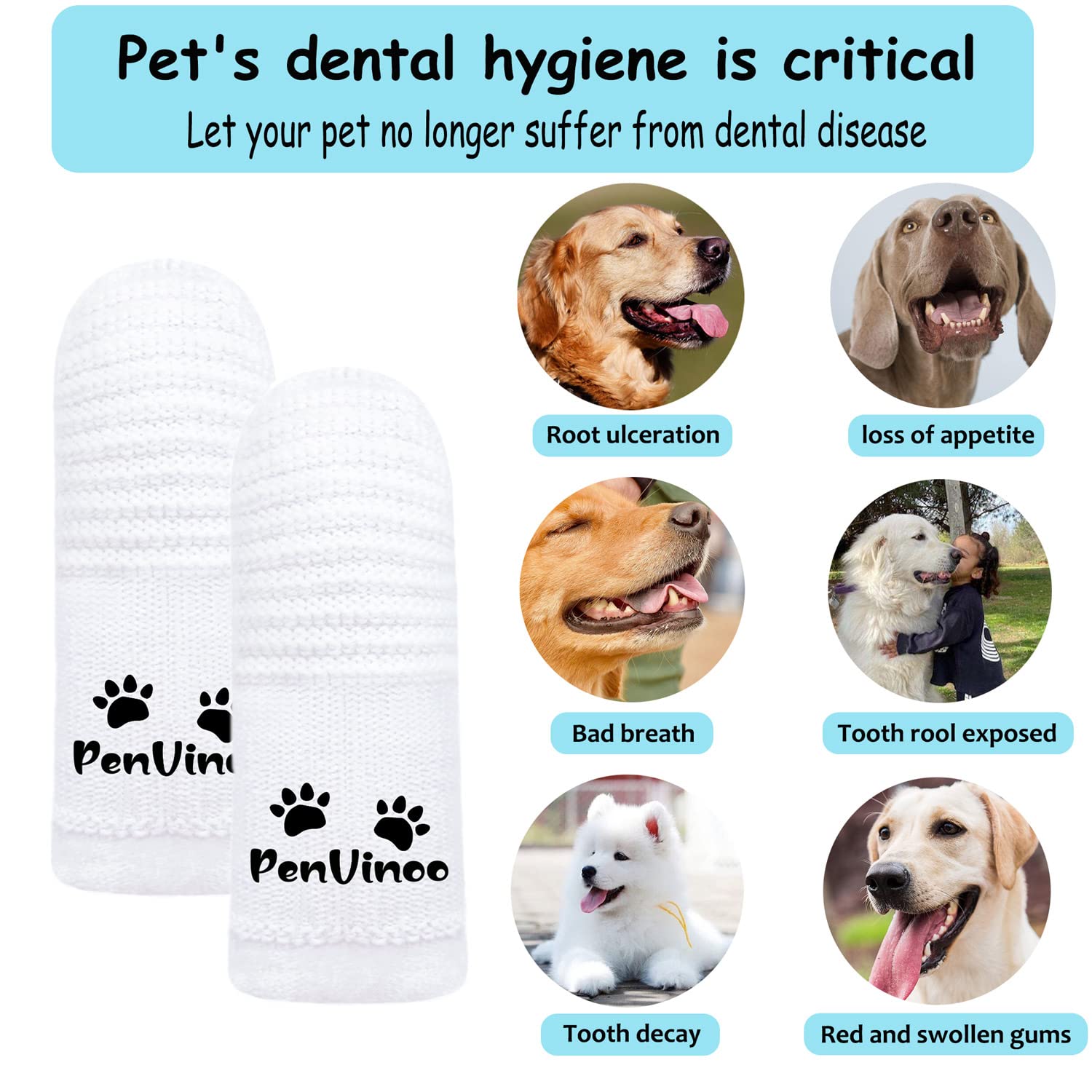 PenVinoo set shows three brush types for complete care