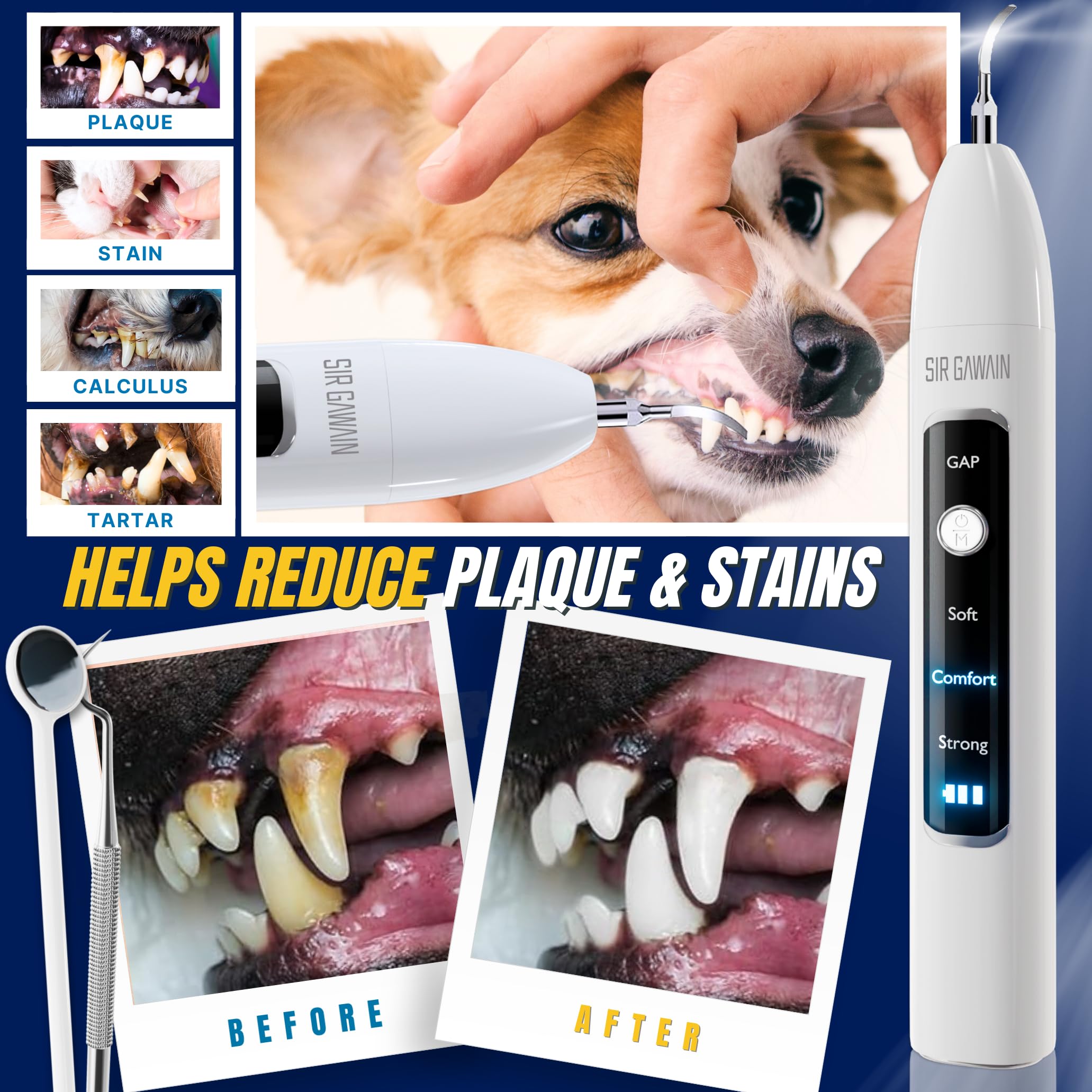 SIRGAWAIN interchangeable tips display supports different sizes and sensitivities.