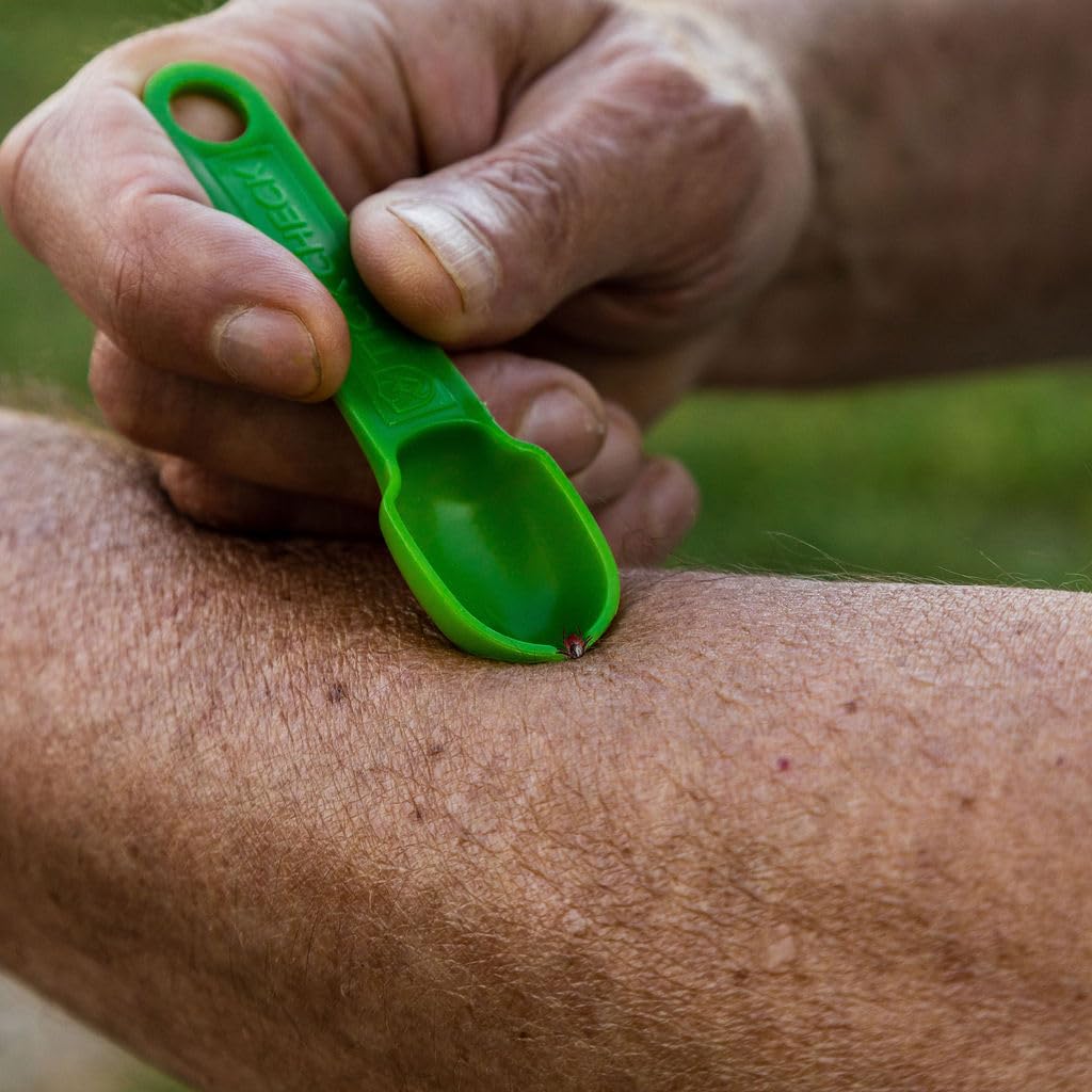 TickCheck tick remover spoon safe for dogs and cats during grooming and outside.