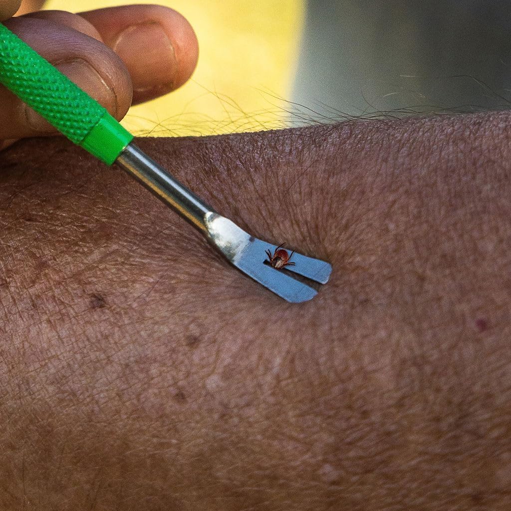 TickCheck Premium Tick Remover Kit university-tested design for safe embedded tick removal