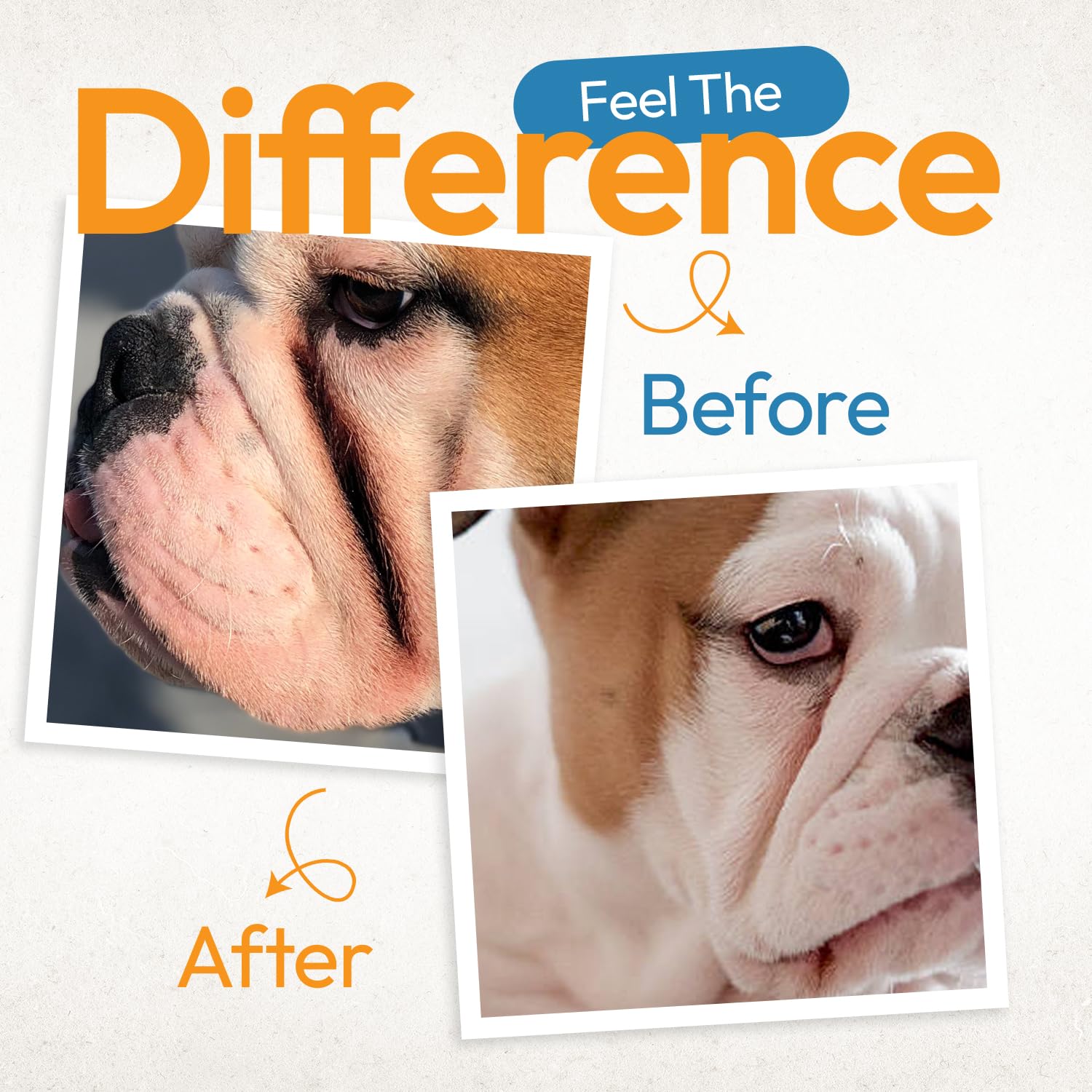 Yibesi 200-count pack emphasizes value for regular use.